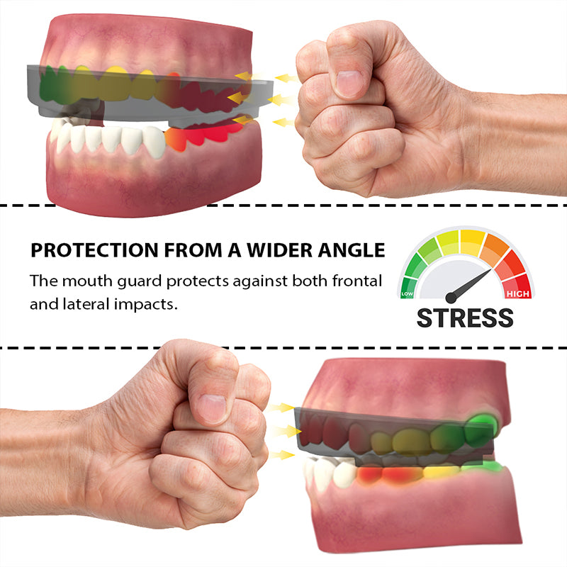 Sport Mouth Guard